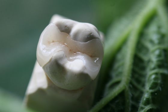 प्राकृतिक देख सभी चीनी मिट्टी के बरतन लिबास EMAX डेंटल क्राउन