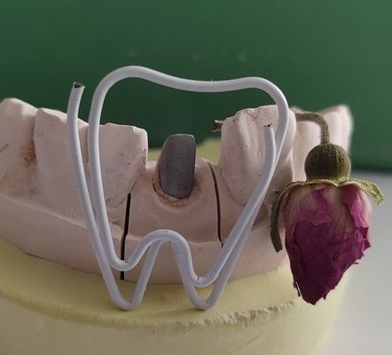 एंडोडोंटिक उपचार के बाद धातु डेंटल पोस्ट और कोर