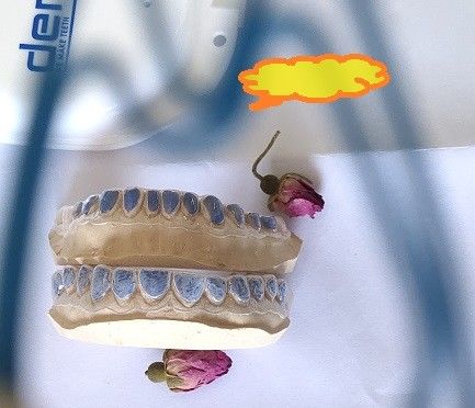कस्टम ISO13485 व्हाइटिंग दांत के लिए ट्रे विरंजन ट्रे
