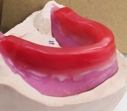 अंतिम पूर्ण Dentures के लिए Trushine चिकित्सकीय रिकॉर्ड ब्लॉक