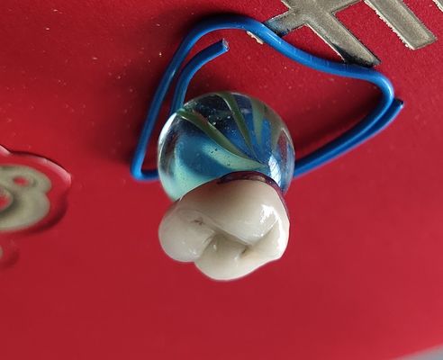 डेंटल लैब उत्पाद सीएडी सीएएम पीएफएम क्राउन पोर्सिलेन धातु से जुड़े हुए हैं