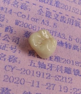 Zirconia CAD CAM Milling द्वारा डेंटल 3 डी प्रिंट